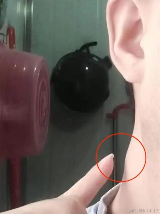 病来如山倒配图